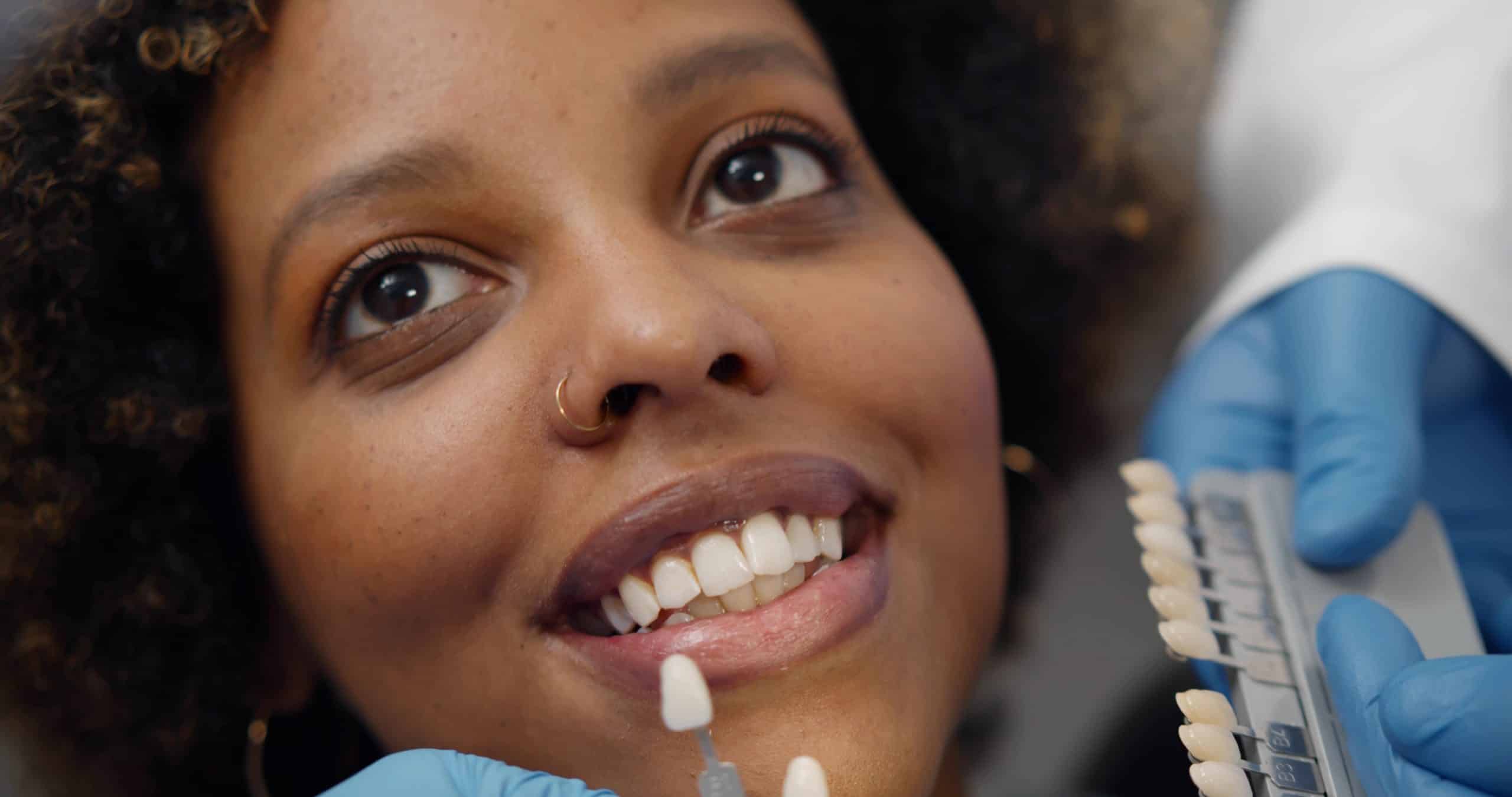 The cost of dental veneers: is it worth the investment?