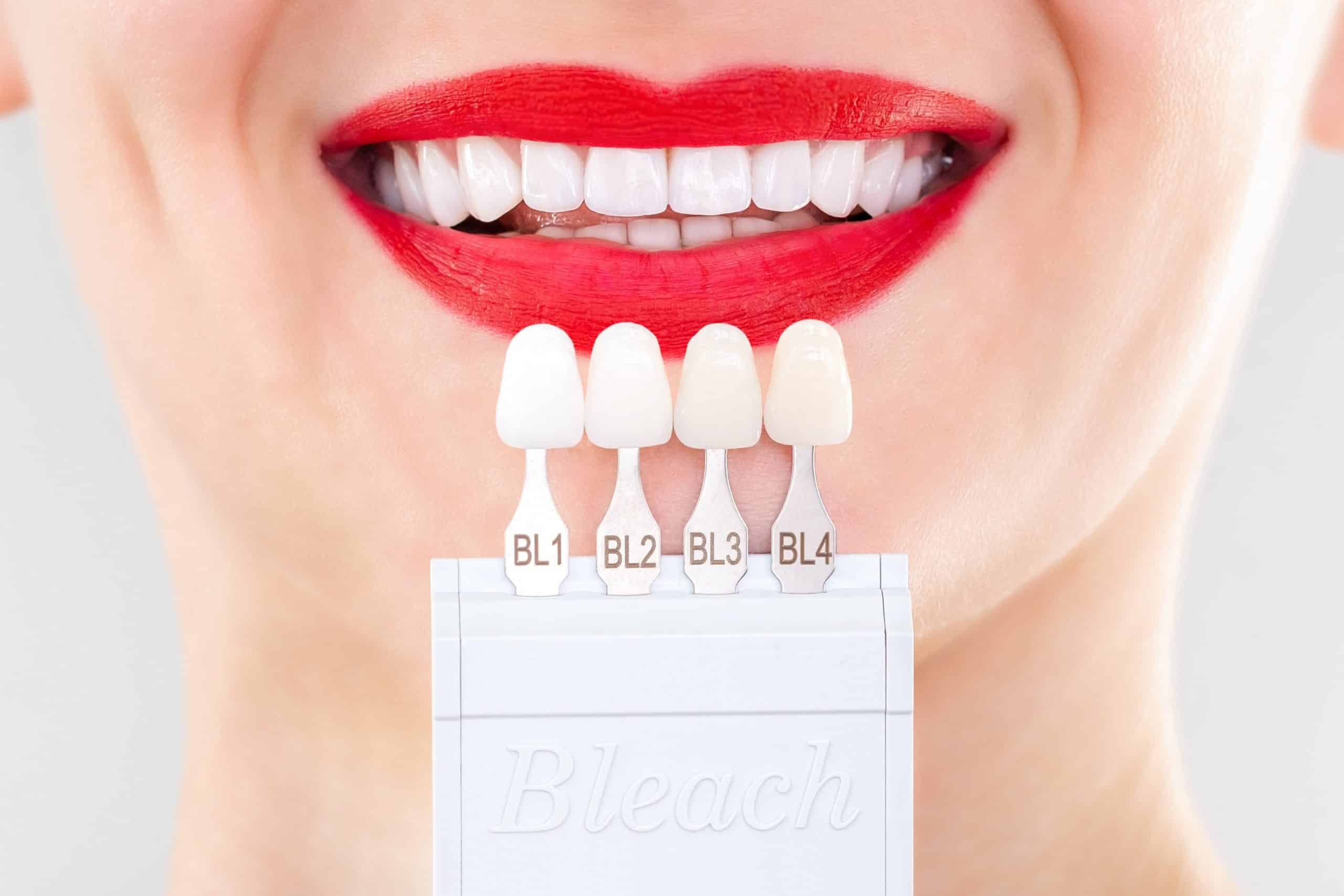 Understanding Different Types of Dental Veneers: Pros and Cons Explained by Flintridge Dental Studio