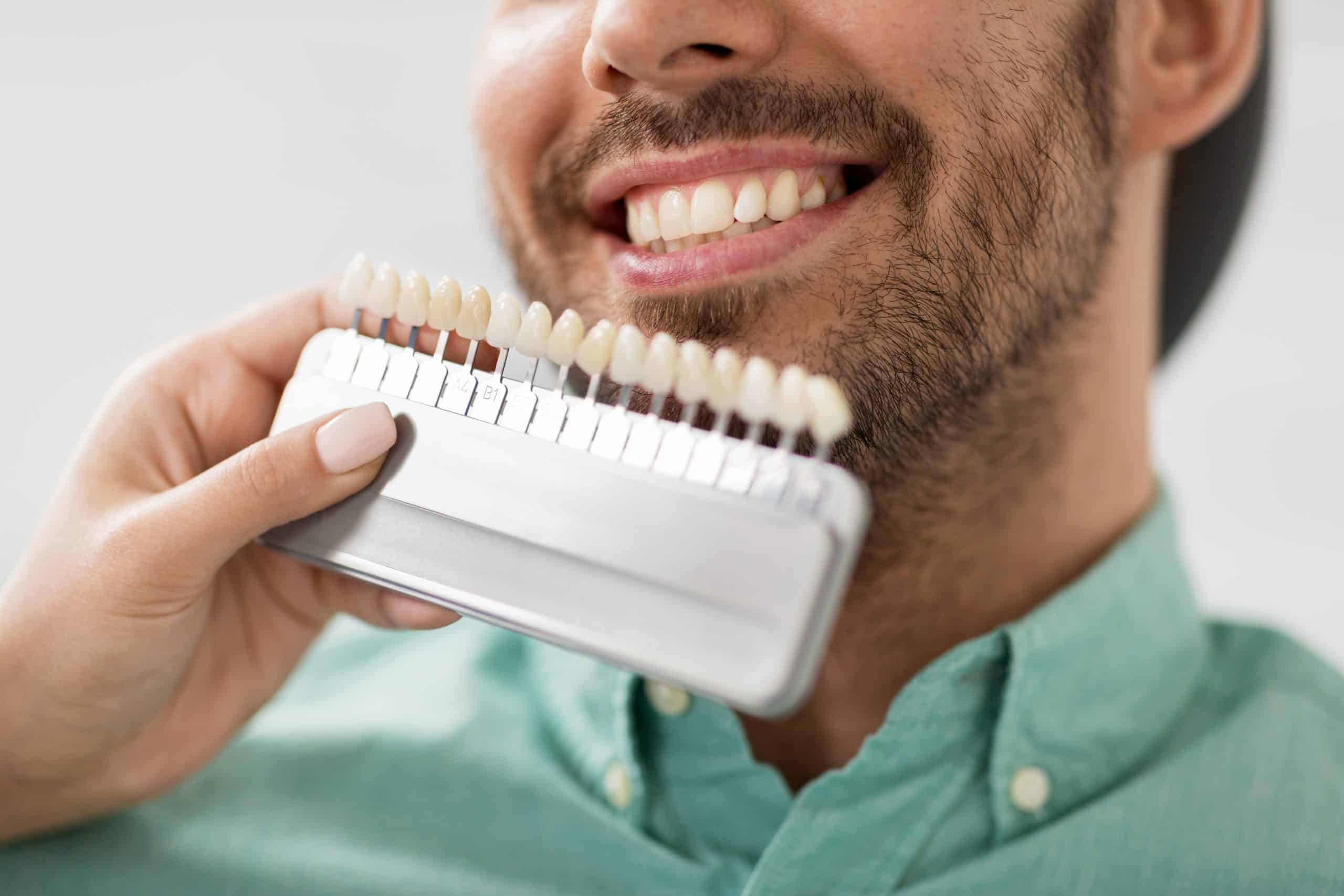 The Impact of Dental Veneers on Your Oral Health and Well-being: Insights from Flintridge Dental Studio
