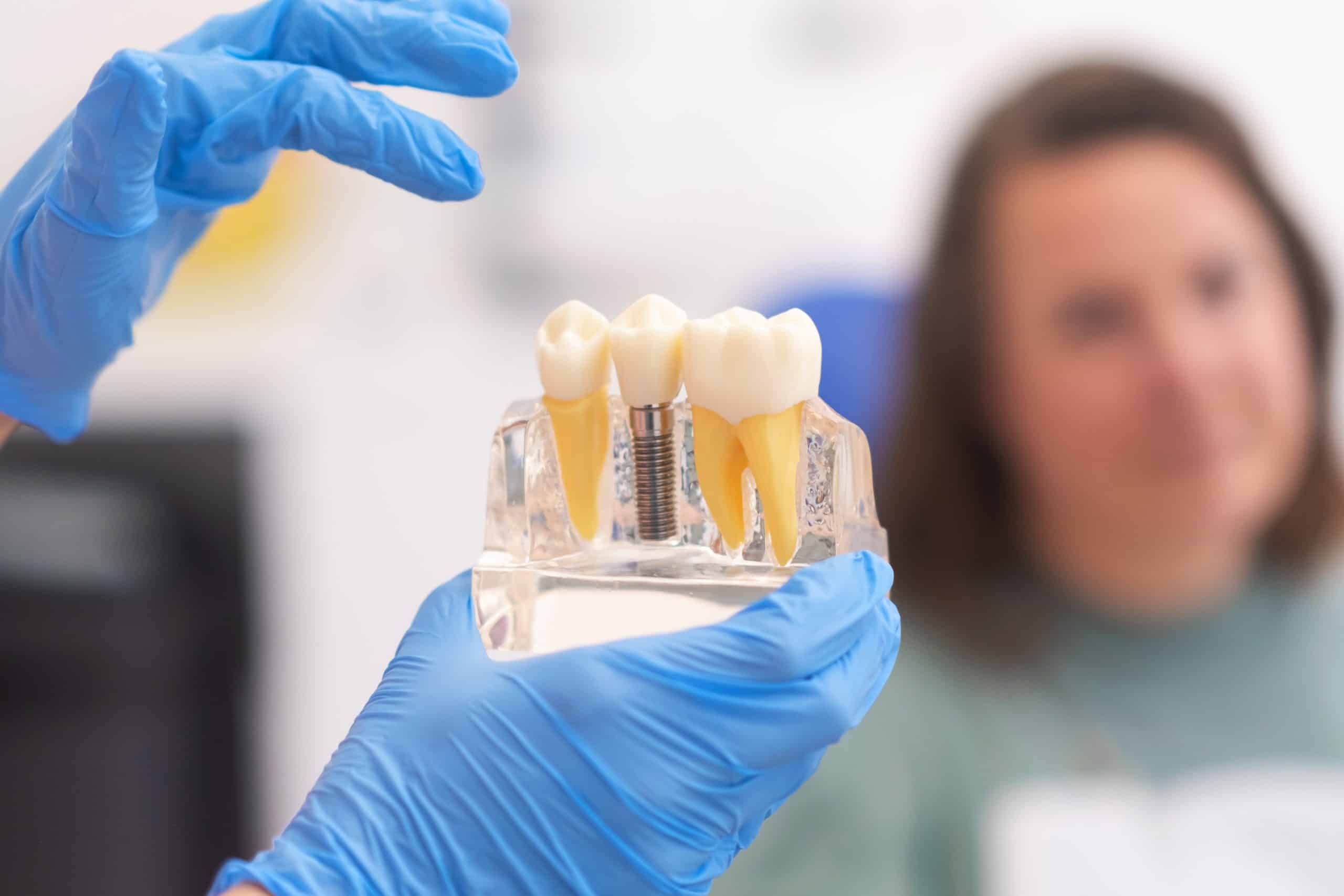 All-on-4 Vs. Traditional Dental Implants: An In-Depth Comparison at Flintridge Dental Studio, CA